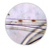 chitosan - mixed type