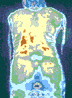 Comforto body heat scan