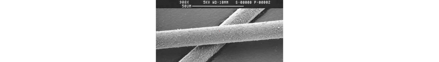 Surface view of Epitropic fibers