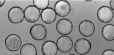 Cross sectional view of Epitropic fibers